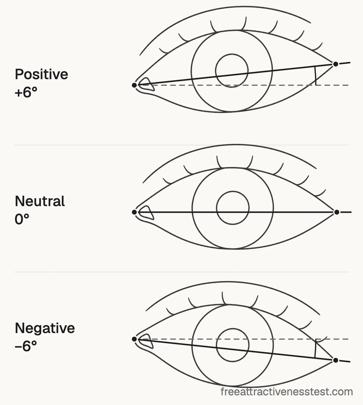 Line drawing comparing positive, neutral and negative canthal tilt: the outer eye corner sits higher than, level with, or lower than the inner corner.